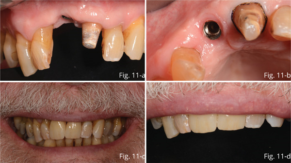Figure 11