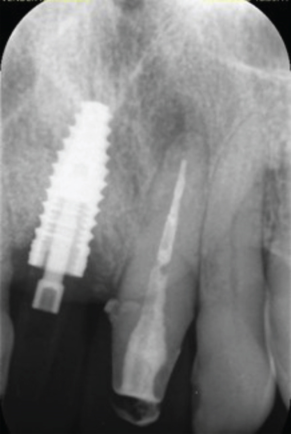 Figure 10