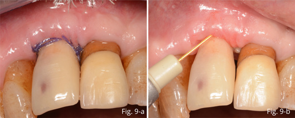 Figure 9