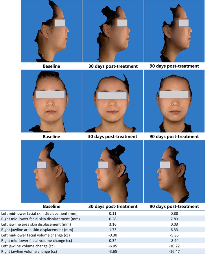 FIGURE 4