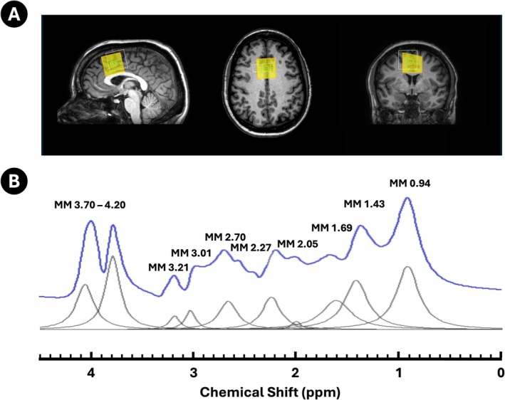 FIGURE 3
