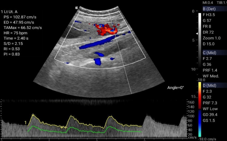 Figure 6