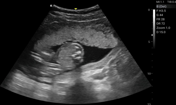 Figure 8