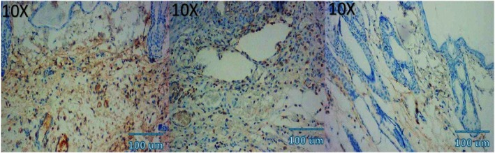 Figure 11