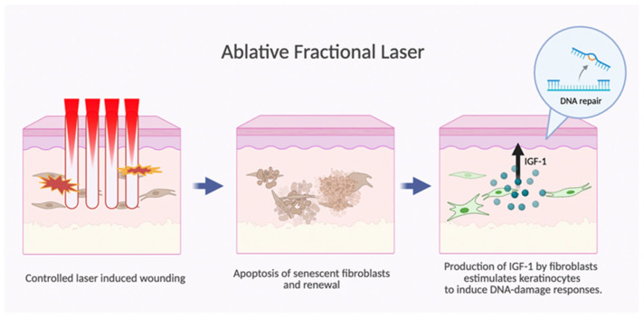 Figure 15