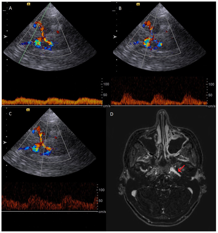 Figure 4