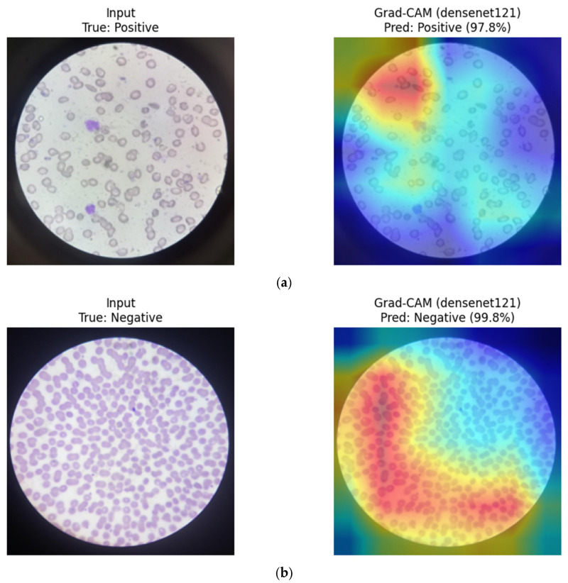 Figure 22