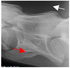 Figure 13