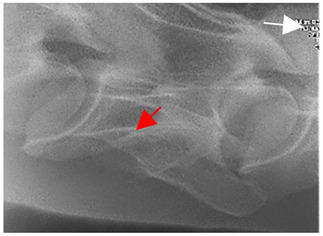 Figure 16