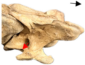 Figure 17
