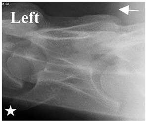 Figure 18