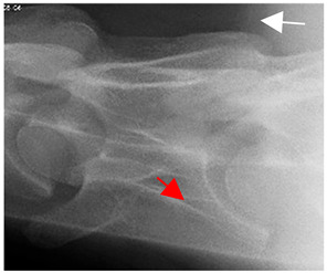 Figure 19