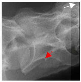 Figure 22