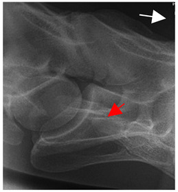 Figure 25