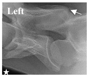 Figure 30