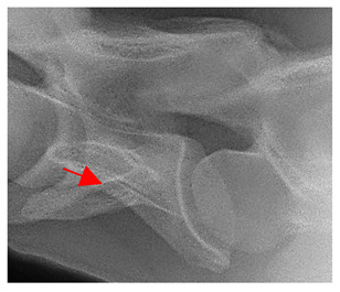 Figure 31