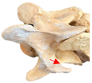 Figure 32