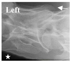 Figure 33