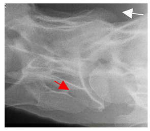 Figure 34