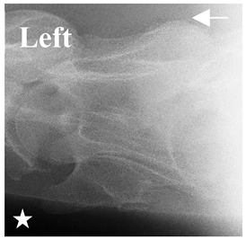 Figure 42