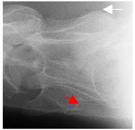 Figure 43