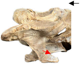 Figure 44
