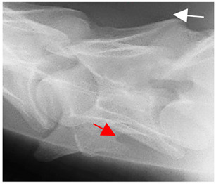 Figure 46