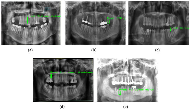 Figure 18