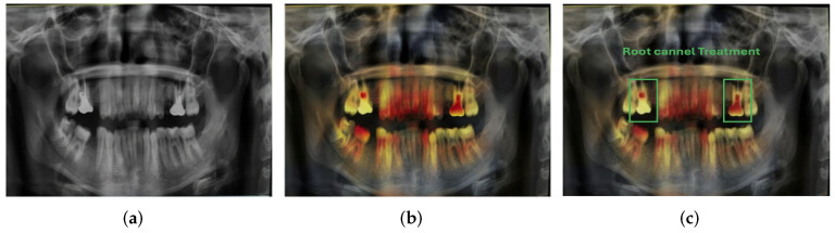 Figure 19