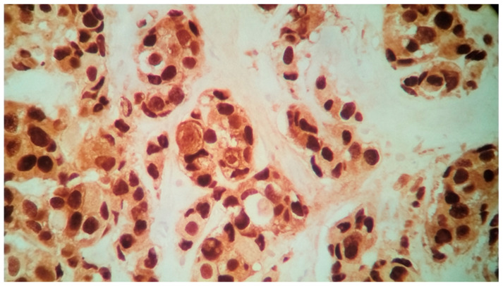Figure 10