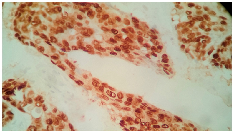 Figure 11