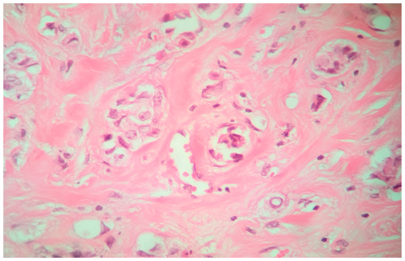 Figure 13