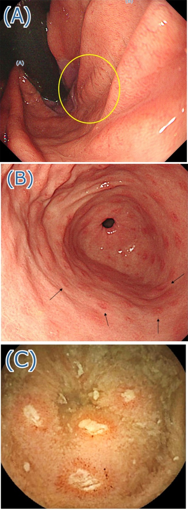 FIGURE 2