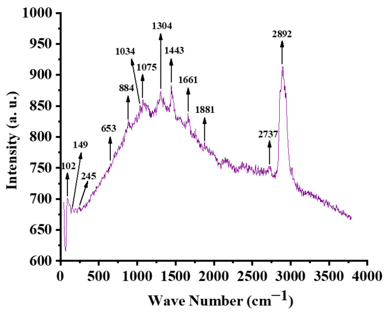 Figure 21