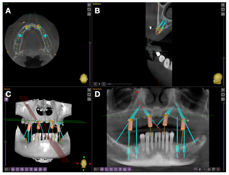 Figure 4