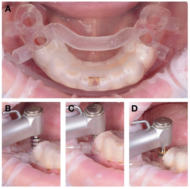 Figure 9