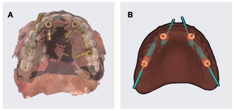 Figure 10