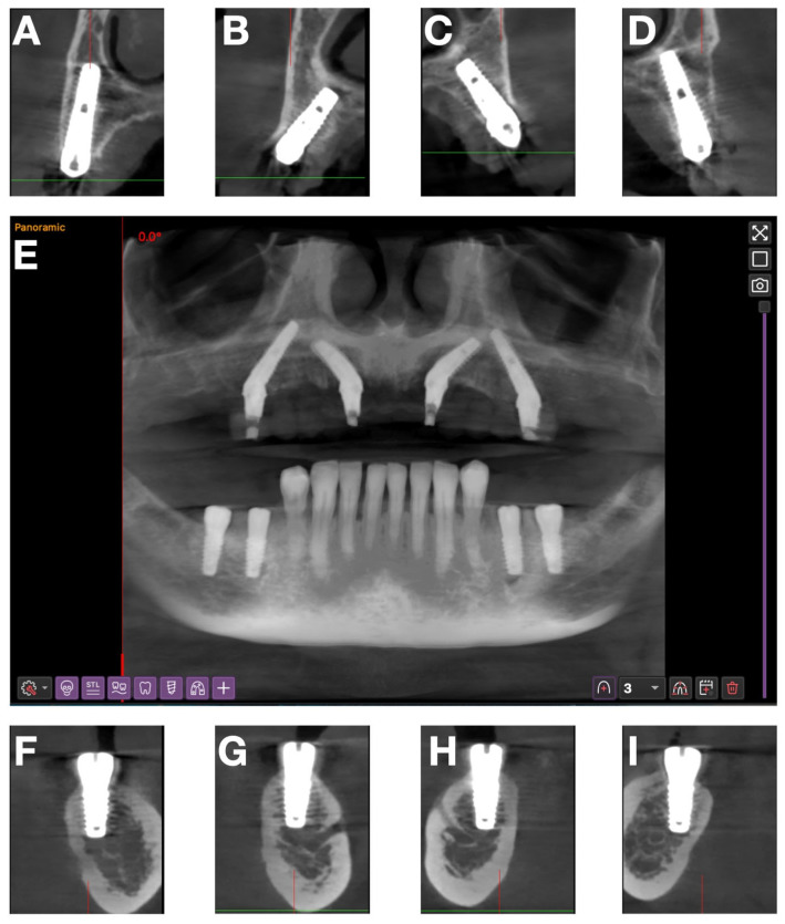 Figure 11