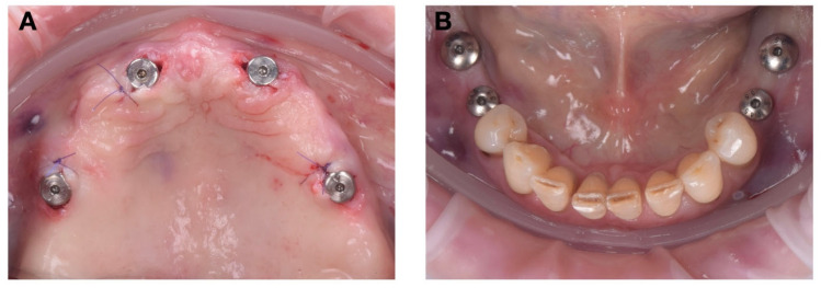Figure 12