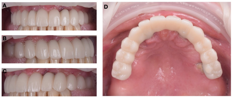 Figure 13
