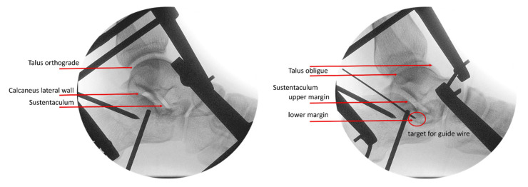 Figure 8