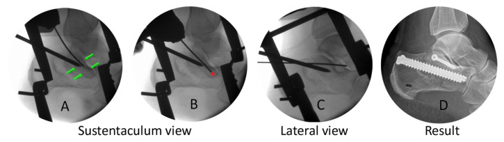 Figure 10