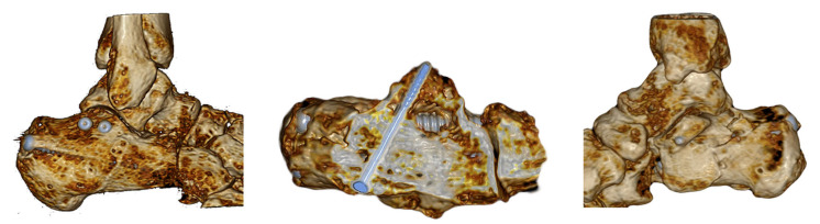 Figure 11