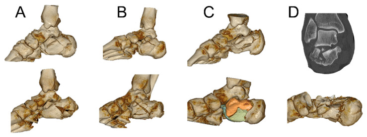 Figure 12