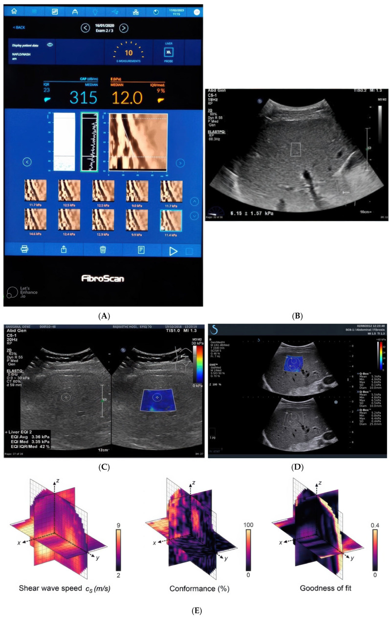 Figure 4