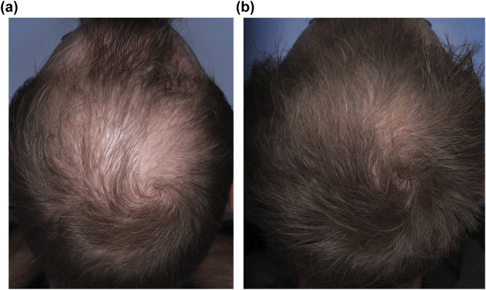 FIGURE 3