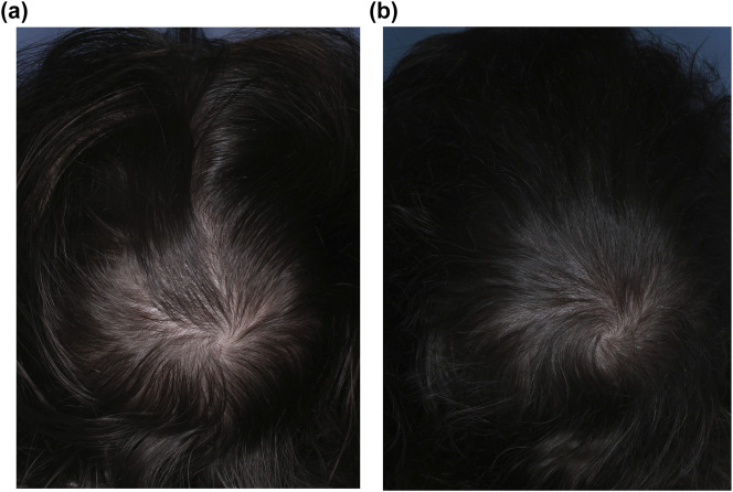 FIGURE 4