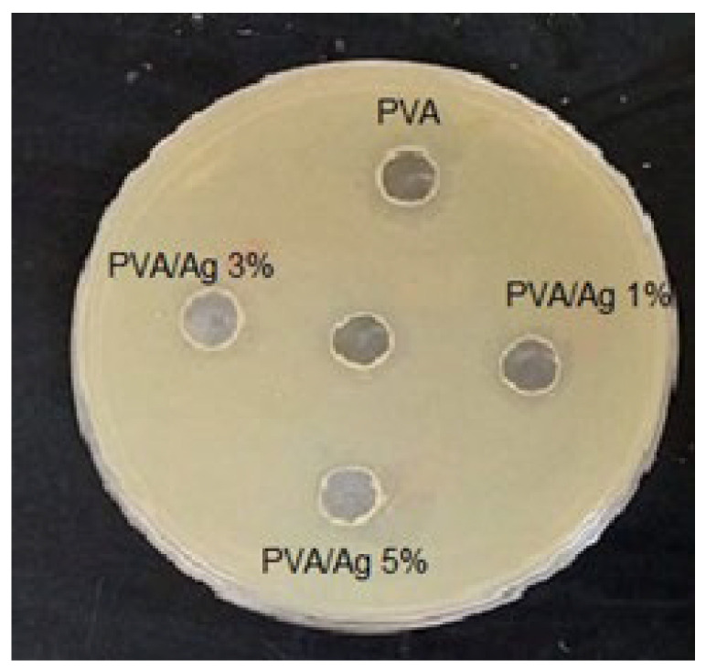 Figure 14