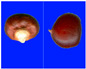Figure 31