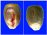 Figure 44